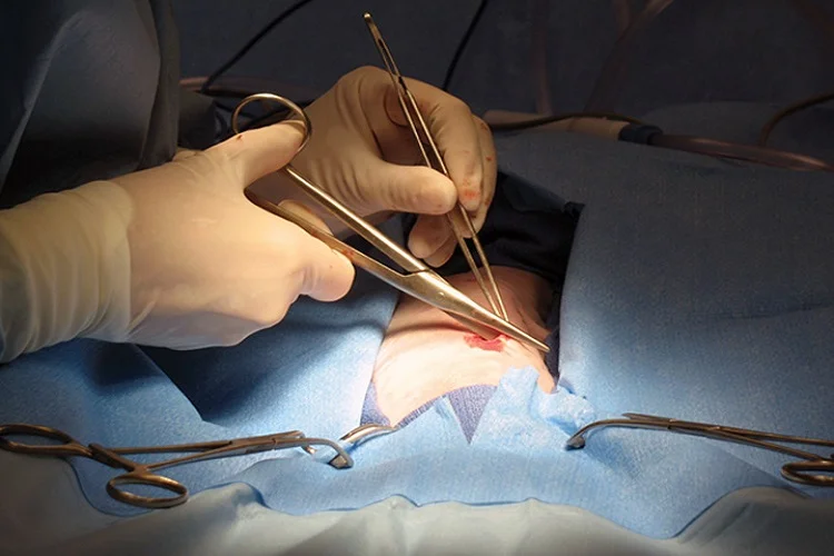 What Is Post Gastric Sleeve Diet All About? Why Diet After The Weight Reduction Surgical Treatment